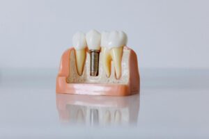 dental treatment in aberdeen