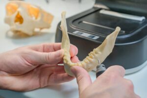 dental implant aberdeen