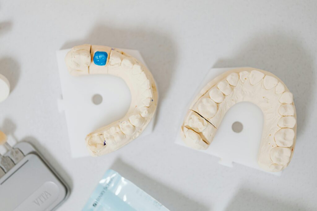 dental implant