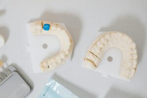 dental implant